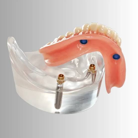 Snap-in dentures near me