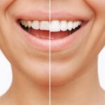 How to Choose the Right Cosmetic Dentist in Century City