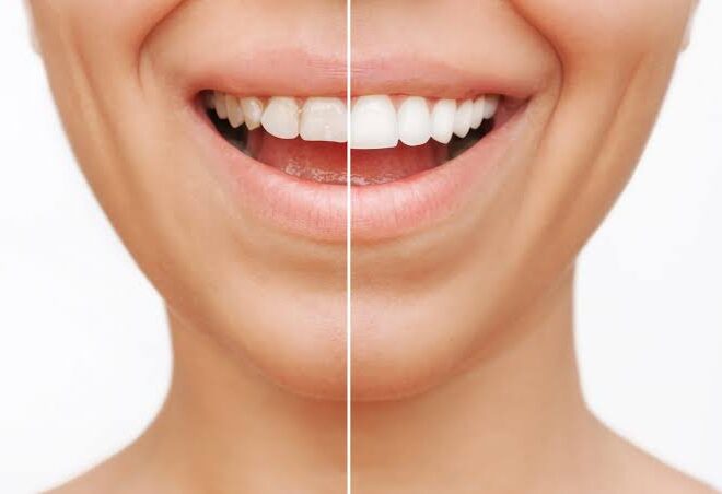How to Choose the Right Cosmetic Dentist in Century City