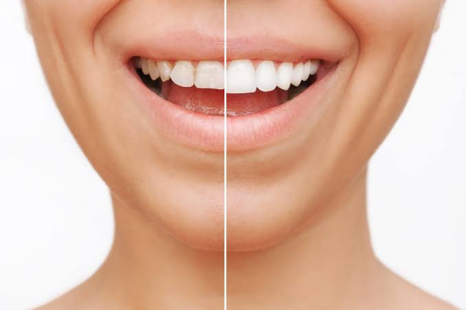 How to Choose the Right Cosmetic Dentist in Century City